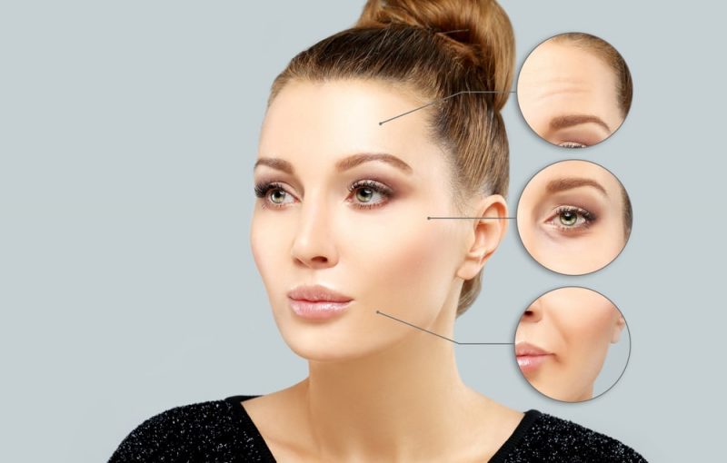 הזרקות בוטוקס בדרום (תמונה ממאגר shutterstock, צילום: LADO)